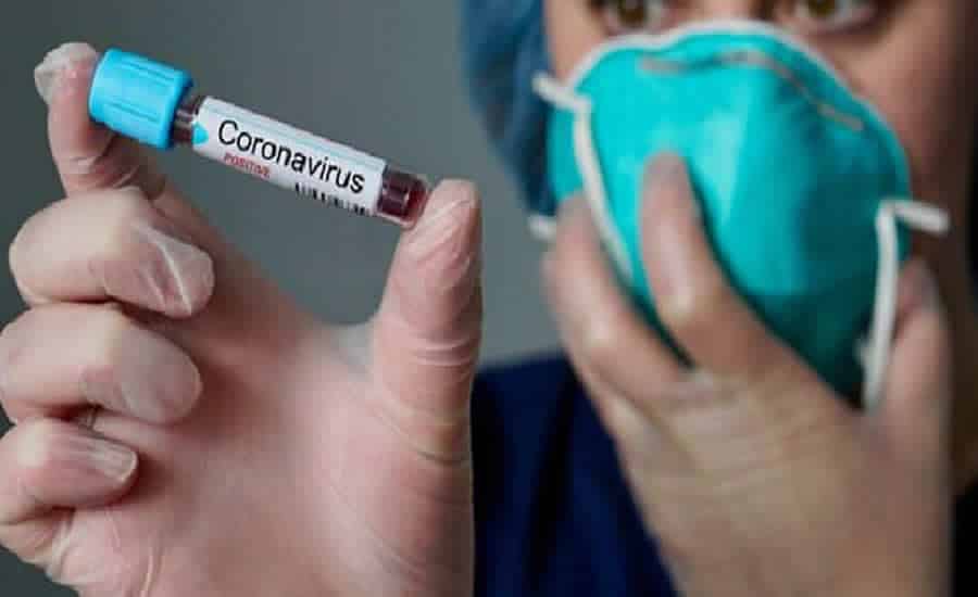 Resultado de imagem para exame coronavirus
